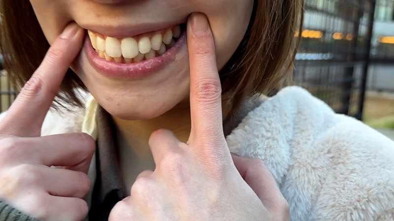 【特価】口腔観察VOL.3 4名59分お買い得セット 画像11