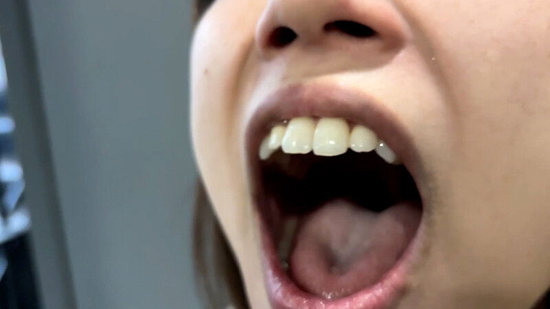 【特価】口腔観察VOL.3 4名59分お買い得セット 画像12