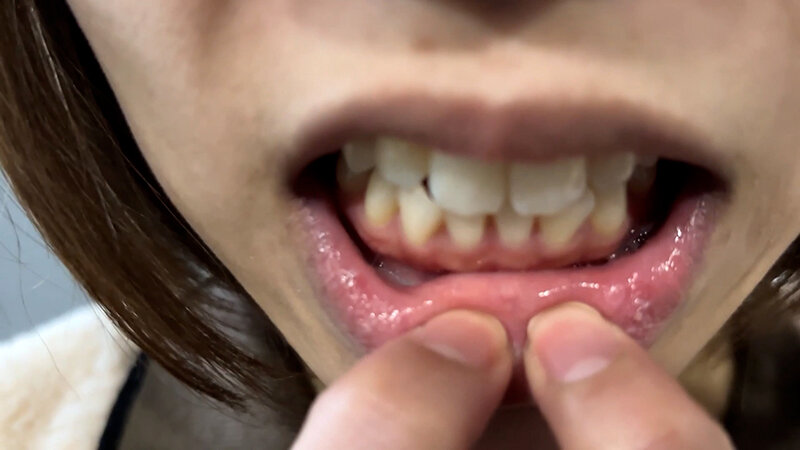 【特価】口腔観察VOL.3 4名59分お買い得セット 画像13