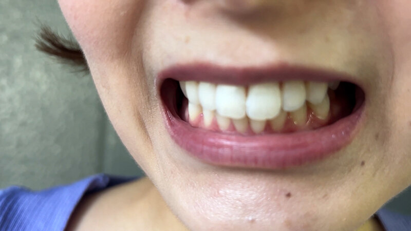 【特価】口腔観察VOL.3 4名59分お買い得セット 画像18