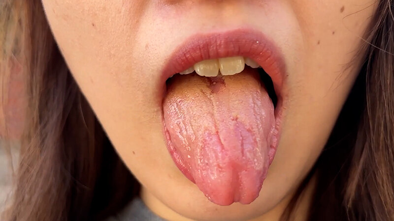 【特価】口腔観察VOL.3 4名59分お買い得セット 画像2