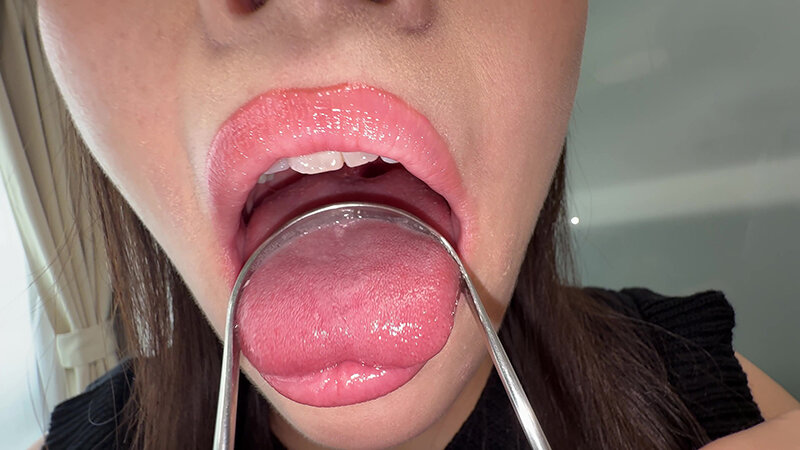 【個人撮影】原美織の舌ブラシで「汚舌苔」採取 画像12