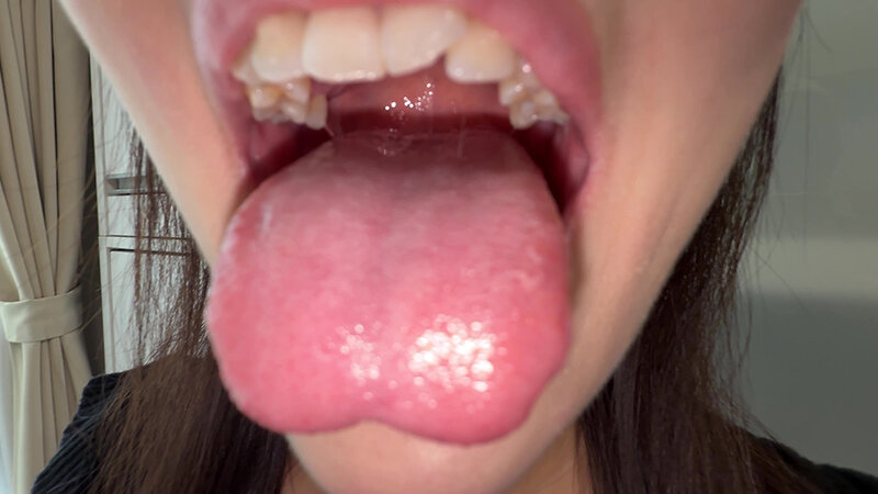【個人撮影】原美織の舌ブラシで「汚舌苔」採取 画像14