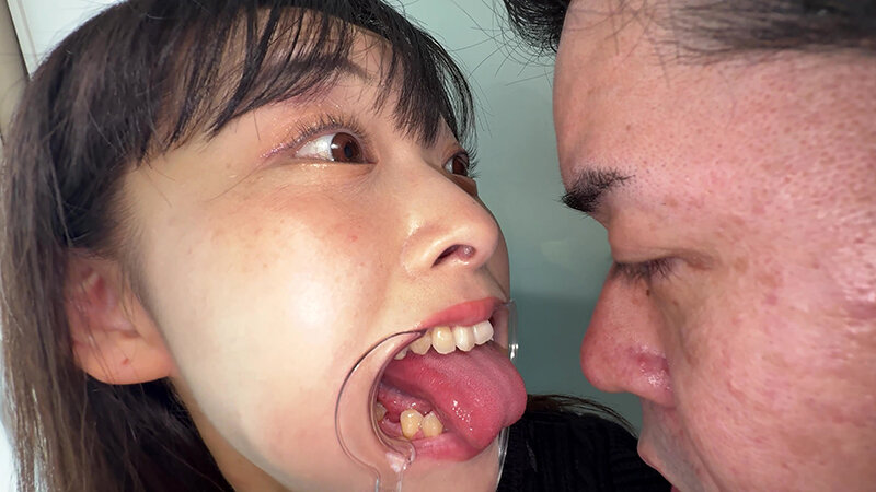 【個人撮影】原美織の舌ブラシで「汚舌苔」採取 画像20