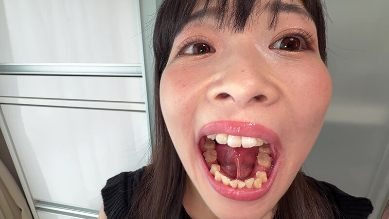 【個人撮影】原美織の舌ブラシで「汚舌苔」採取 画像3