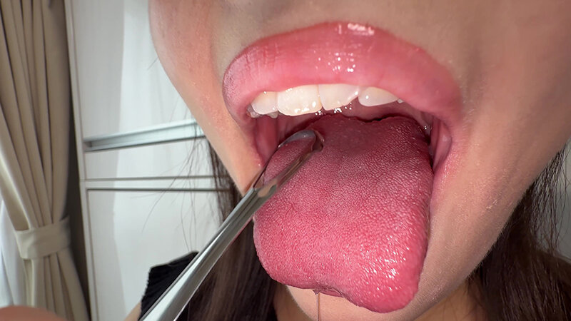 【個人撮影】原美織の舌ブラシで「汚舌苔」採取 画像6