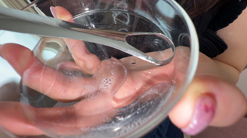 【個人撮影】原美織の舌ブラシで「汚舌苔」採取 画像10